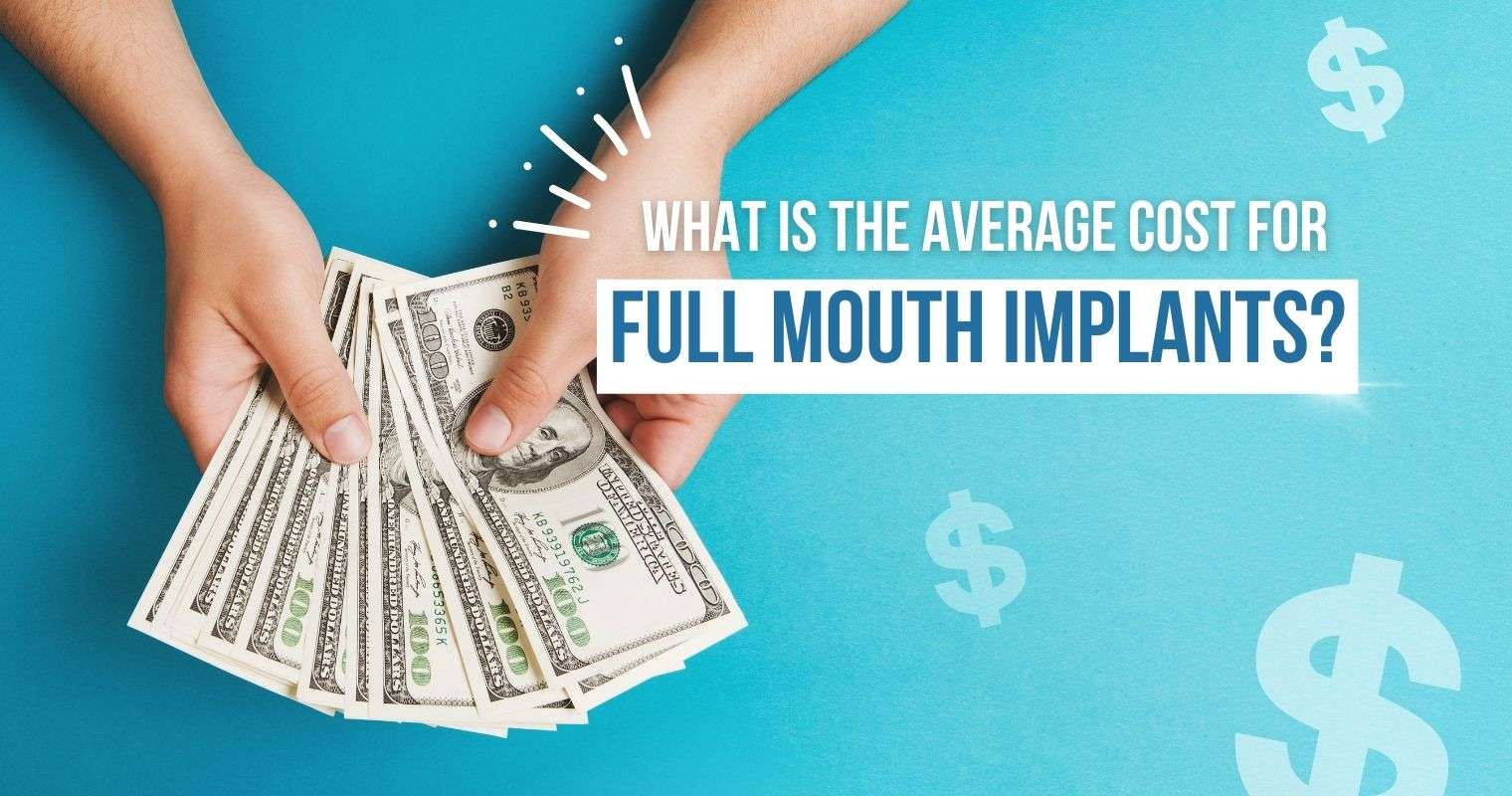 Average Cost for Full Mouth Implants Average Cost for Full Mouth Implants