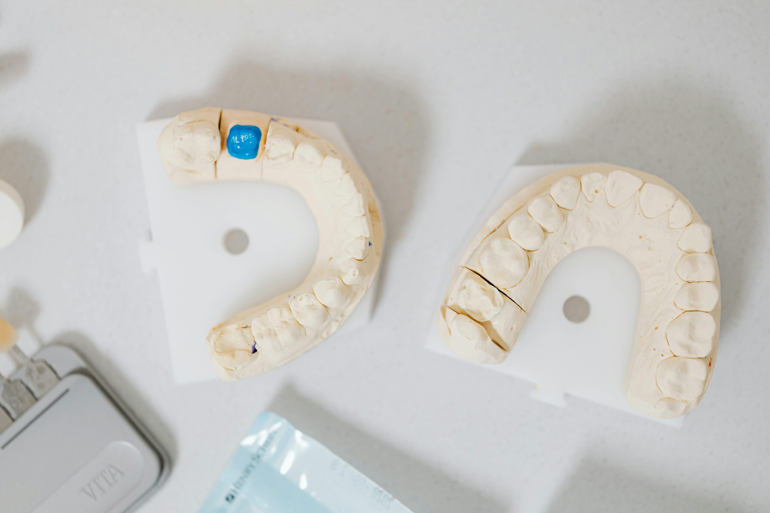 cavities teeth models with filling
