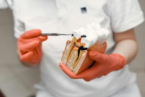 dentist pointing to model of tooth