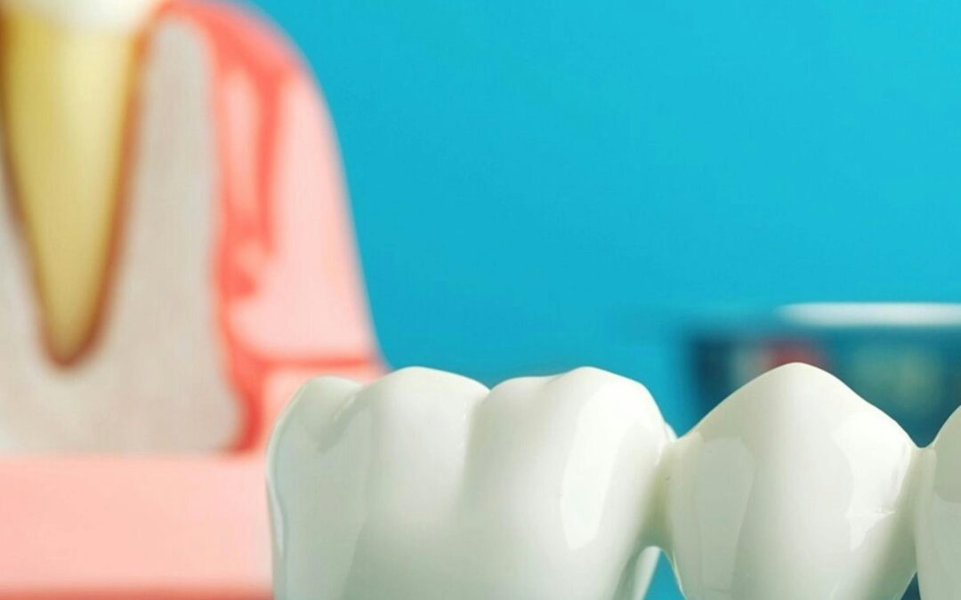 Your Complete Guide to Dental Bridges: Restore Your Smile with Confidence