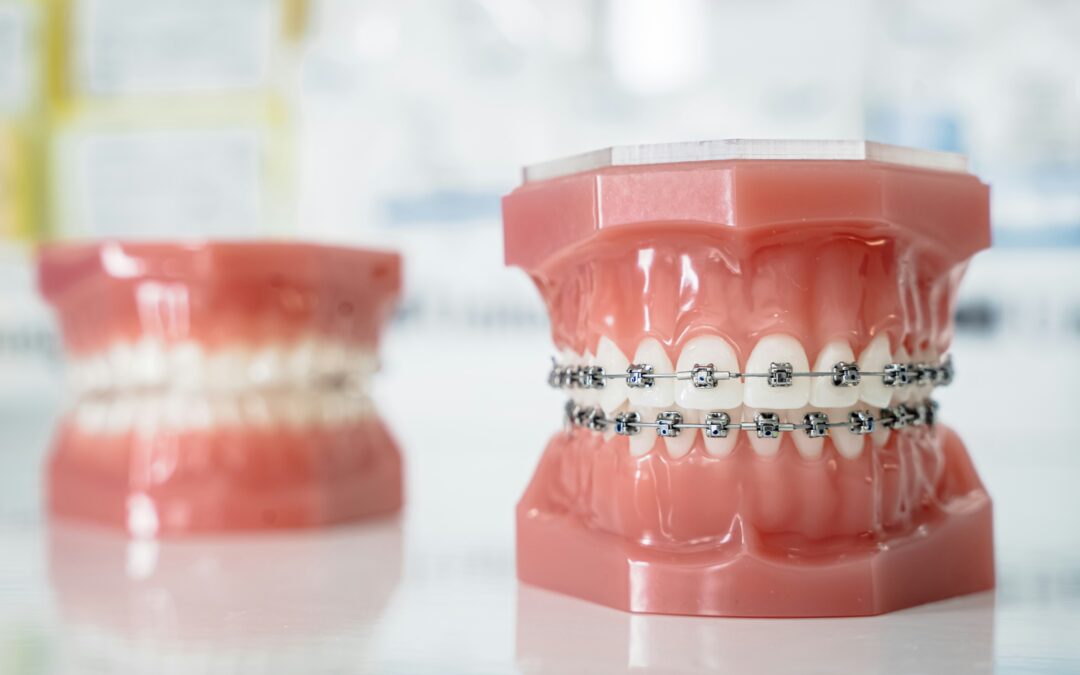 Comprehensive Orthodontic Dentistry at Your Local Dentist Office