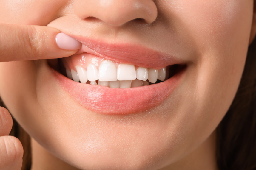 September Is Gum Care Month: Understanding and Preventing Gum Disease